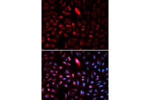 Immunofluorescence analysis of U2OS cells using TCP1 antibody (ABIN5971010). (TCP1 alpha/CCTA anticorps)