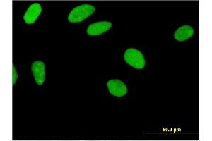 Immunofluorescence of monoclonal antibody to ZNF35 on HeLa cell.