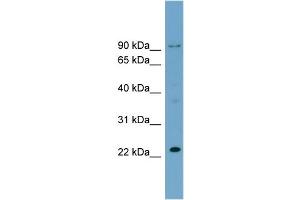 WB Suggested Anti-C15orf15  Antibody Titration: 0. (RSL24D1 anticorps  (Middle Region))