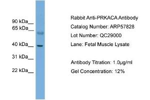 WB Suggested Anti-PRKACA  Antibody Titration: 0.