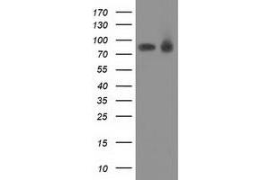 Western Blotting (WB) image for anti-Protein Kinase C, epsilon (PRKCE) antibody (ABIN1500230) (PKC epsilon anticorps)
