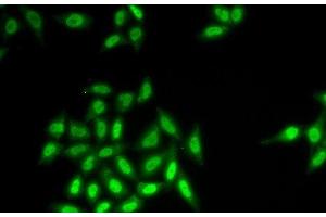 Immunofluorescence analysis of HeLa cells using SETMAR Polyclonal Antibody (SETMAR anticorps)