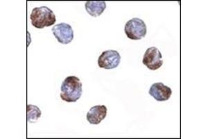 Immunocytochemistry of MettL7a in MCF7 cells with this product at 2 μg/ml. (METTL7A anticorps  (Center))