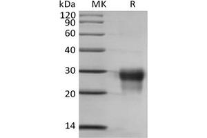 Placenta Growth Factor (PGF) protein (His tag)