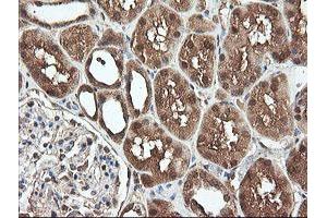 Image no. 13 for anti-Pyridoxamine 5'-Phosphate Oxidase (PNPO) antibody (ABIN1500318)