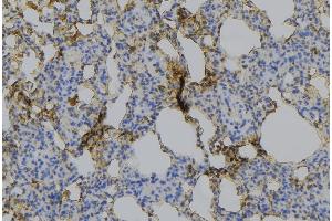 ABIN6275217 at 1/100 staining Mouse lung tissue by IHC-P. (Macrophage Mannose Receptor 1 anticorps  (Internal Region))