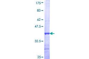 Image no. 1 for Fucosyltransferase 2 (Secretor Status Included) (FUT2) (AA 51-150) protein (GST tag) (ABIN1354526)
