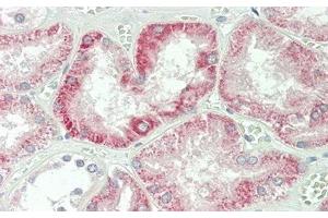 Detection of IFNb in Human Kidney Tissue using Polyclonal Antibody to Interferon Beta (IFNb) (IFNB1 anticorps  (AA 22-187))