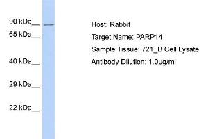Host: Rabbit Target Name: PARP14 Sample Type: 721_B Whole Cell lysates Antibody Dilution: 1. (PARP14 anticorps  (C-Term))