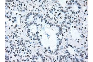 Image no. 2 for anti-B-Raf proto-oncogene, serine/threonine kinase (BRAF) antibody (ABIN1496961)