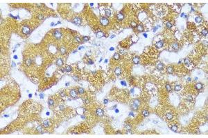 Immunohistochemistry of paraffin-embedded Human liver using ACOX2 Polyclonal Antibody at dilution of 1:100 (40x lens).