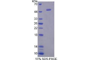 Image no. 1 for Interferon, alpha 5 (IFNA5) (AA 24-189) protein (His tag,GST tag) (ABIN4990630)