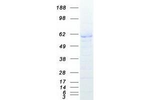 Validation with Western Blot