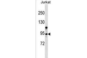 ZMYM6 Antibody (N-term) (ABIN1539123 and ABIN2849256) western blot analysis in Jurkat cell line lysates (35 μg/lane). (ZMYM6 anticorps  (N-Term))