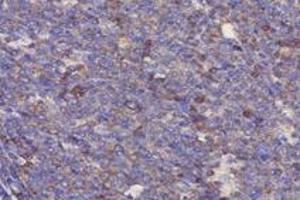 Immunohistochemistry analysis of paraffin-embedded human tonsil using,RPL10 (ABIN7075428) at dilution of 1: 4000