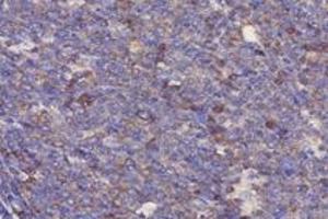 Immunohistochemistry analysis of paraffin-embedded human tonsil using,RPL10 (ABIN7075428) at dilution of 1: 4000 (RPL10 anticorps)