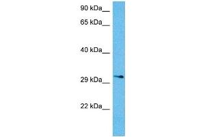 Host:  Mouse  Target Name:  KCNIP3  Sample Tissue:  Mouse Brain  Antibody Dilution:  1ug/ml (DREAM anticorps  (N-Term))