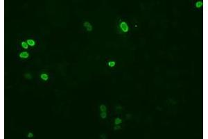 Anti-XRCC1 mouse monoclonal antibody (ABIN2453798) immunofluorescent staining of COS7 cells transiently transfected by pCMV6-ENTRY XRCC1 (RC204952). (XRCC1 anticorps)