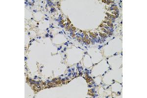 Immunohistochemistry of paraffin-embedded mouse lung using CD59 antibody. (CD59 anticorps)