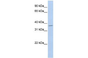 WB Suggested Anti-SLFNL1 Antibody Titration: 0. (Schlafen-Like 1 anticorps  (Middle Region))