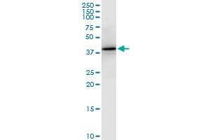 PTX3 monoclonal antibody (M01), clone 5B7.