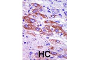 Immunohistochemistry (IHC) image for anti-Casein Kinase 1, delta (CSNK1D) antibody (ABIN3003190) (Casein Kinase 1 delta anticorps)