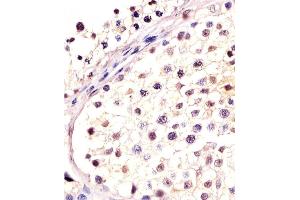 Antibody staining DPPA4 in human testis tissue sections by Immunohistochemistry (IHC-P - paraformaldehyde-fixed, paraffin-embedded sections).