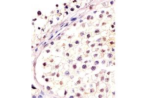Antibody staining DPPA4 in human testis tissue sections by Immunohistochemistry (IHC-P - paraformaldehyde-fixed, paraffin-embedded sections). (DPPA4 anticorps  (N-Term))