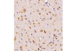 Immunohistochemistry of paraffin embedded mouse brain using SRP14 (ABIN7075596) at dilution of 1:300 (400x lens)