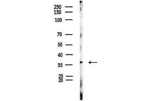 Western blot analysis of lysates from EC304 cells(heat-shock, 45 min treatment), using HIF1AN Antibody at 1/1000 dilution.