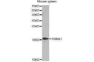 Western blot analysis of extracts of mouse spleen, using SSNA1 antibody. (SSNA1 anticorps)