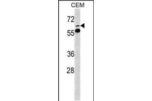 Western blot analysis of FKBP10 Antibody in CEM cell line lysates (35ug/lane)