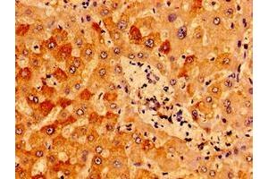 Immunohistochemistry of paraffin-embedded human liver tissue using ABIN7156987 at dilution of 1:100 (IFT46 anticorps  (AA 1-304))