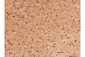 IHC-P Image MC1 Receptor antibody [C2C3], C-term detects MC1R protein at membrane on mouse fore brain by immunohistochemical analysis. (MC1 Receptor anticorps  (C-Term))