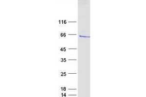 Validation with Western Blot