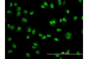 Immunofluorescence of monoclonal antibody to USP15 on HeLa cell. (USP15 anticorps  (AA 1-235))