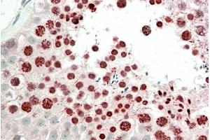 ABIN1590026 (5µg/ml) staining of paraffin embedded Human Testis.