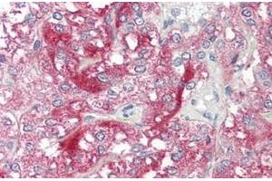 Human Adrenal: Formalin-Fixed, Paraffin-Embedded (FFPE)