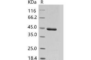 Western Blotting (WB) image for Chitinase 3-Like 1 (Cartilage Glycoprotein-39) (CHI3L1) protein (His tag) (ABIN7320110)