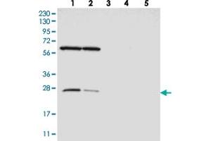 Western blot analysis of Lane 1: RT-4, Lane 2: U-251 MG, Lane 3: Human Plasma, Lane 4: Liver, Lane 5: Tonsil with MRPS15 polyclonal antibody . (MRPS15 anticorps)
