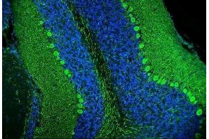 IF analysis of Calbindin using anti-Calbindin antibody (ABIN6719541). (CALB1 anticorps  (AA 2-261))