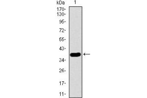 Western blot analysis using SFTPC antibody against HEK293 (1) and SFTPC (AA: 60-180) -hIgGFc transfected HEK293 (2) cell lysate. (Surfactant Protein C anticorps  (AA 60-180))