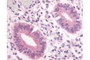 Anti-PDE3A antibody IHC of human uterus.