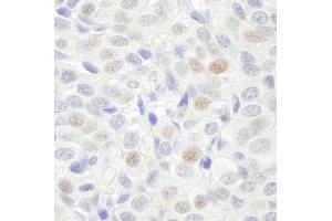 Immunohistochemistry (IHC) image for anti-General Transcription Factor 3C Polypeptide 3 (GTF3C3) (AA 475-525) antibody (ABIN7448586) (General Transcription Factor 3C Polypeptide 3 (GTF3C3) (AA 475-525) anticorps)