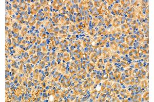 ABIN6259797 and ABIN6277038 at 1/100 staining Mouse kidney tissue by IHC-P.