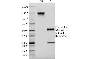 SDS-PAGE Analysis Purified CD9 Mouse Monoclonal Antibody (P1/33/2).