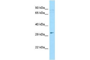 WB Suggested Anti-C9orf24 Antibody Titration: 1. (C9orf24 anticorps  (N-Term))