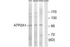 Western blot analysis of extracts from HT-29/A549/NIH-3T3 cells, using ATP2A1 Antibody.