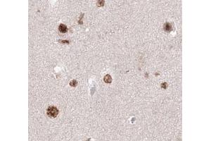anti-Kinesin Family Member 20A (KIF20A) (C-Term) antibody