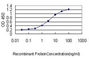 Detection limit for recombinant GST tagged SQSTM1 is approximately 0.